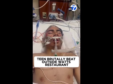 Video: 15-year-old in ICU after brutal beating outside Watts restaurant