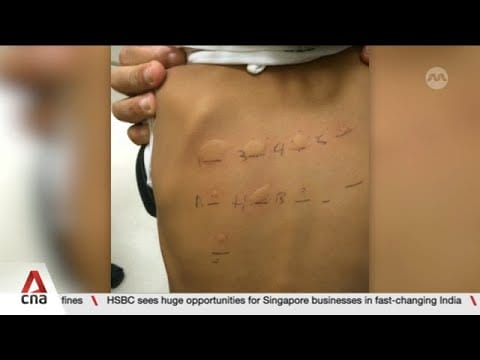 Video: New national study on childhood food allergies in Singapore