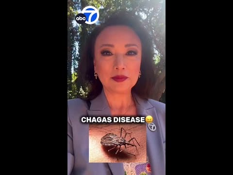 Video:  Chagas disease from ‘kissing bugs’ found in SoCal